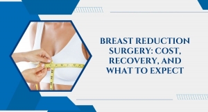 Breast Reduction Surgery: Cost, Recovery, and What to Expect